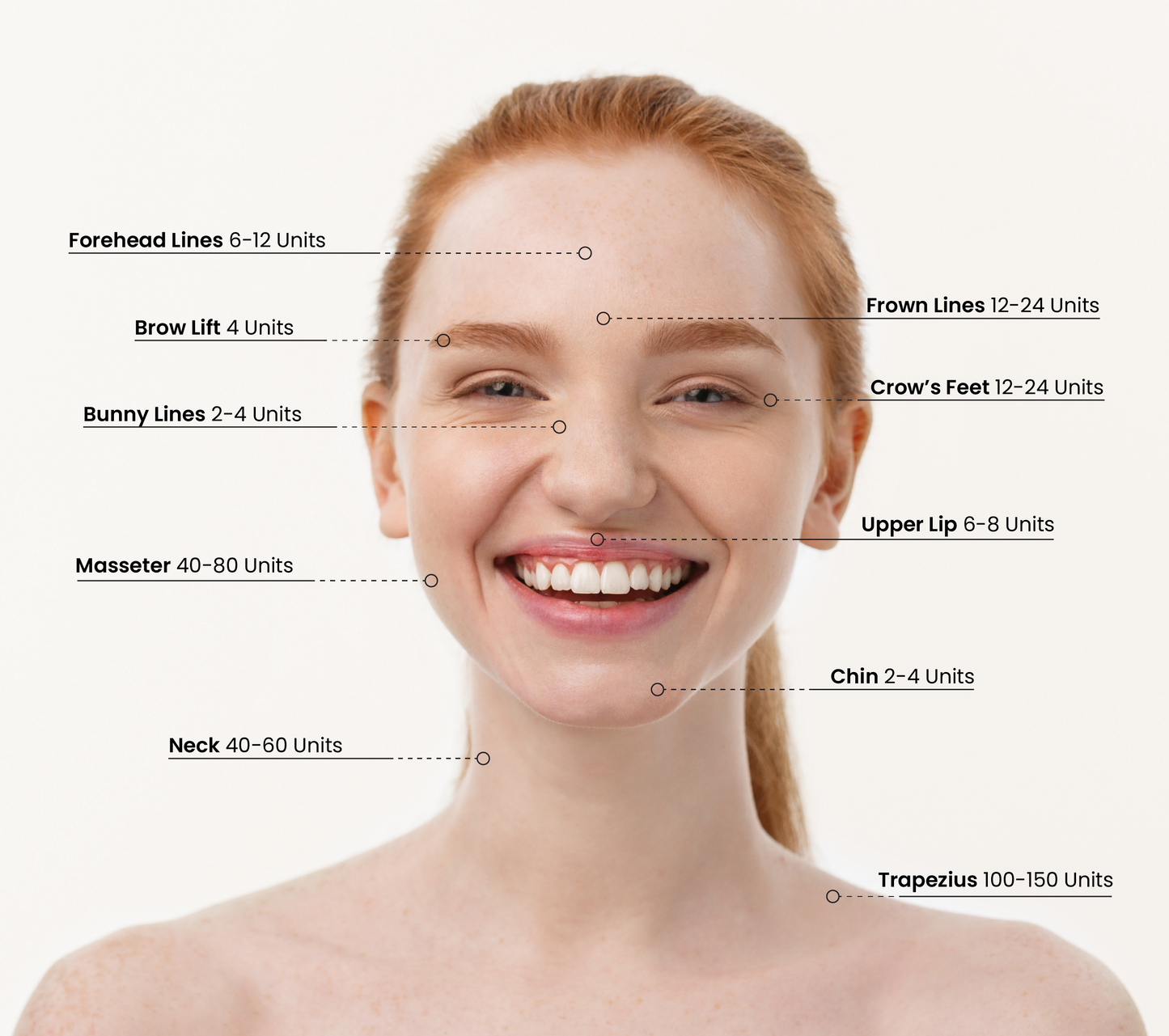 Dysport Minitox Treatment (100 Units)