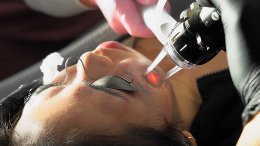 after acne scar treatments