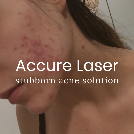 Accure Acne Laser Treatment