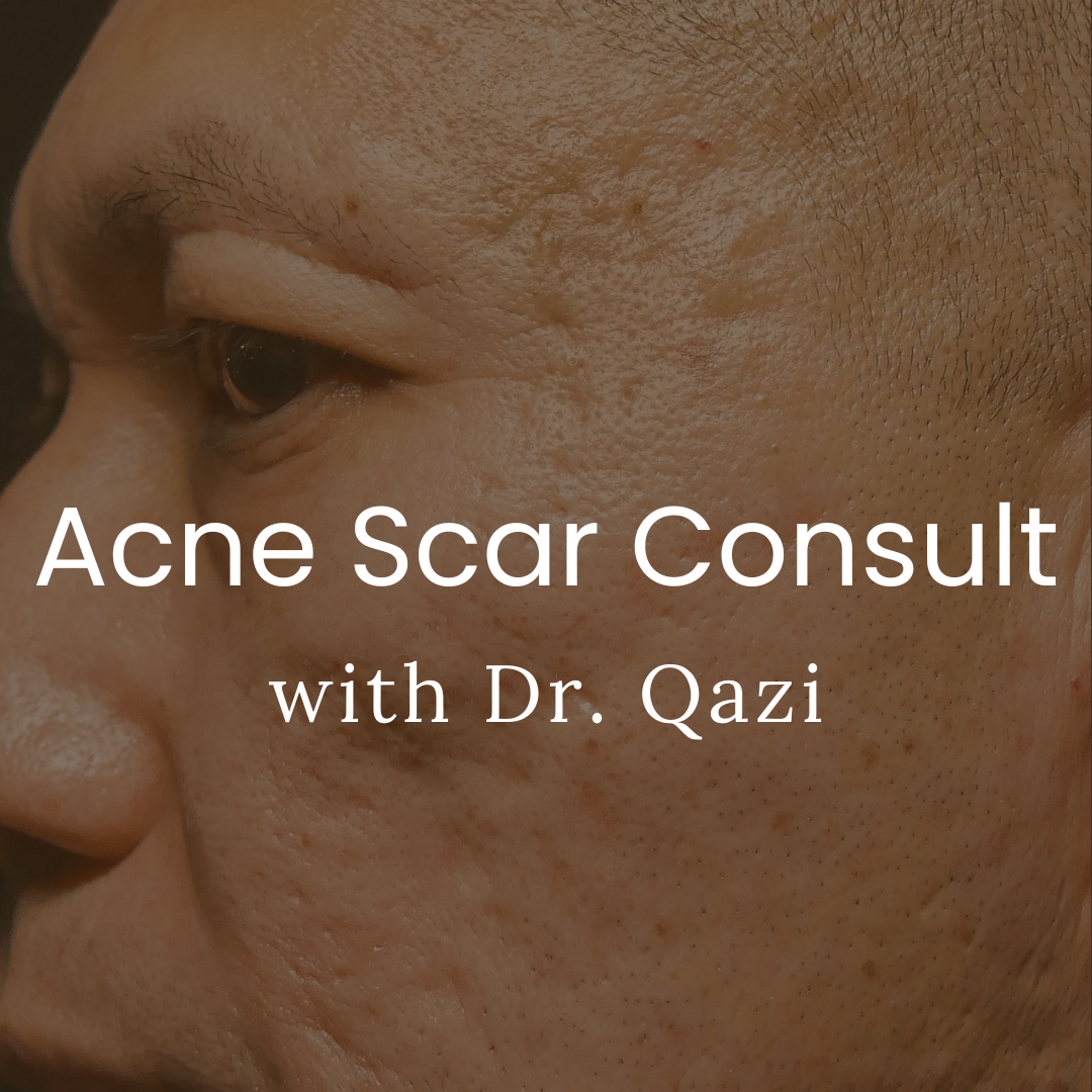 Acne Scar Consultation with Dr. Qazi (20 Minutes)