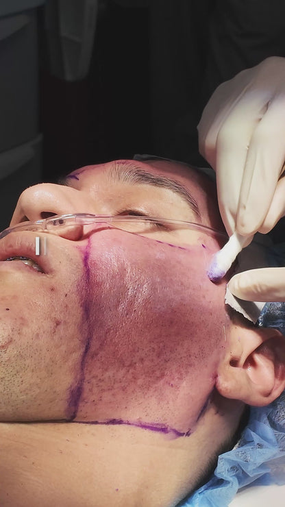 Heliocare Sun Defense Supplement