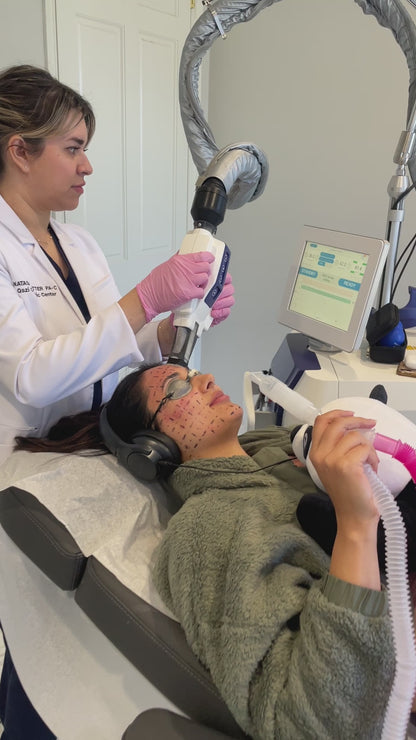 Accure Acne Laser Treatment