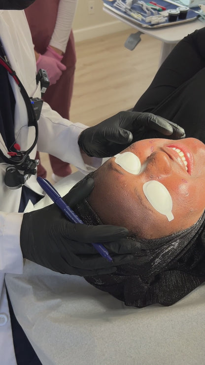 Acne Scar Consultation with Dr. Qazi (20 Minutes)